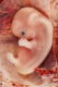 200px 9 Week Human Embryo From Ectopic Pregnancy
